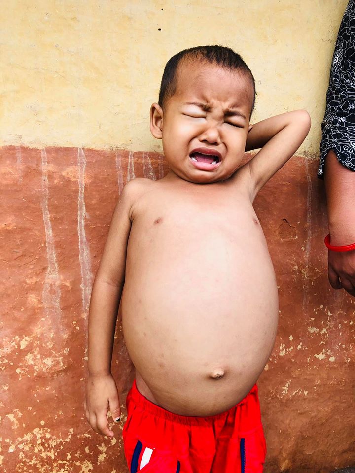 आरुषलाई बचाउन मनकारी हातको खाँचो